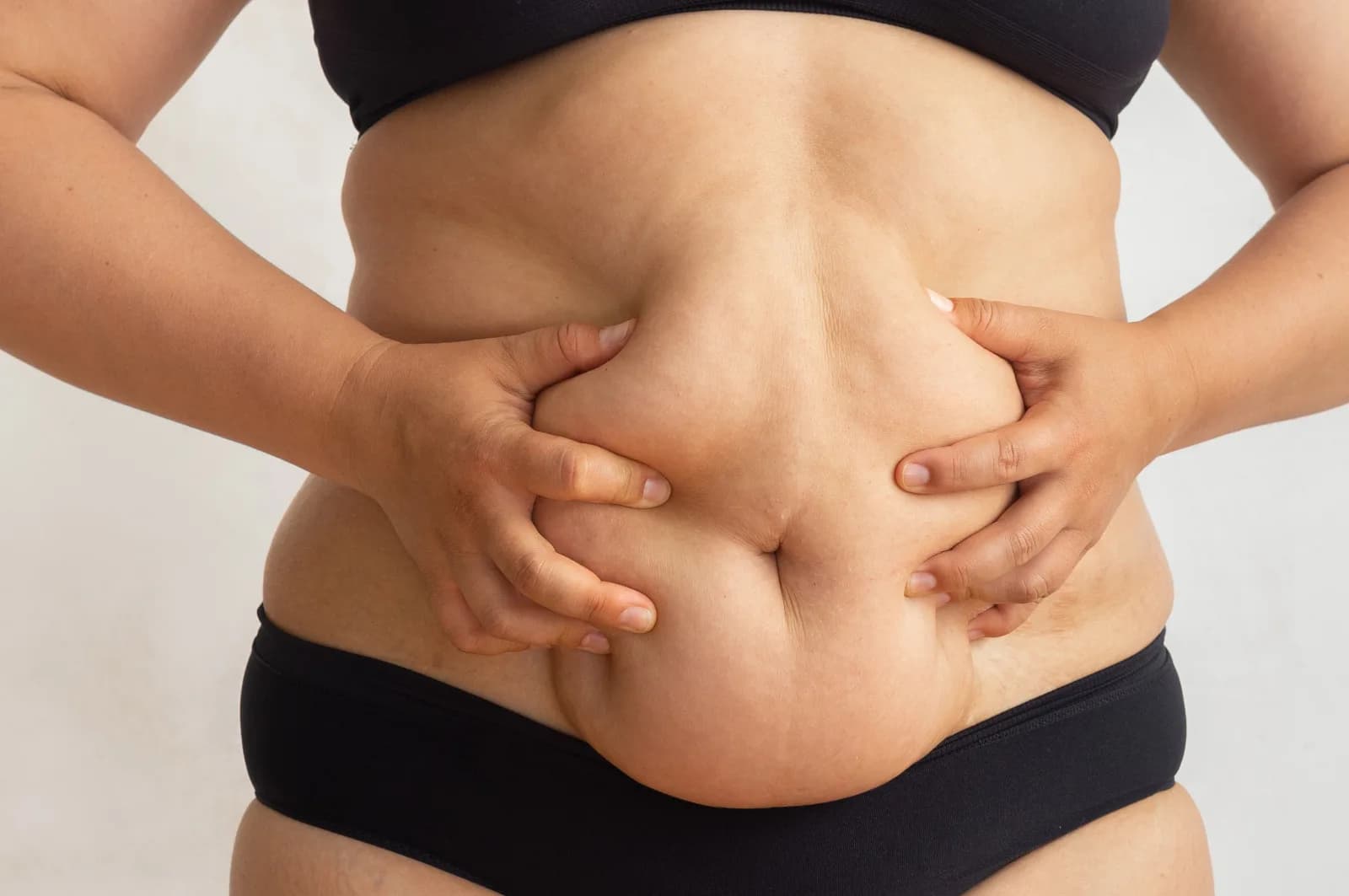 Cirurgia plástica pós-bariátrica: quando o plano de saúde deve cobrir